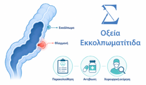 Σχηματική απεικόνιση εκκολπωματίτιδας στο σιγμοειδές έντερο με επιλογές θεραπείας